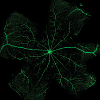 Image: Normal adult mouse retinal vasculature (Photo courtesy of Chavala Laboratory, University of North Carolina).